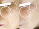 ミエル(miel)の写真