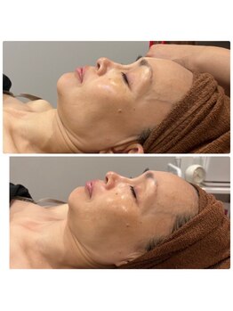 スリーズララ 大船駅前店(Cerise LaLa)/◆毛穴つるん、触れたくなる肌◆