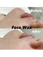 レディエント 北浦和店(Radiant)/フェイスワックス