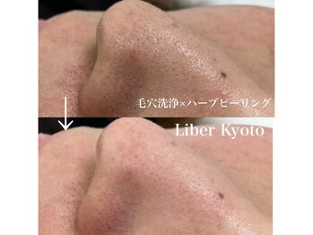 リベルキョウト 京都駅前店(Liber Kyoto)/毛穴レス艶肌コース