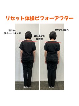 カイロプラクティック カーブ/肩の高さの違いに注目!