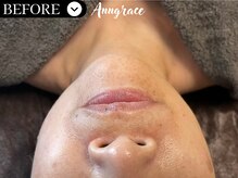 アングレイス(Anngrace)/【ポールシェリー】/Before