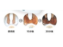 マカナハーブス 吉祥寺(Makana herbs)の雰囲気（化学物質、重金属など毒素や老廃物の排出を促進し体質改善に♪）