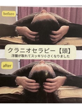 ロージィーローズ(Rosy Rose)の写真/眠りの質を変える、頭のエステ。