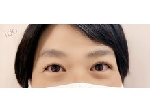 アイドゥ(i.do)/大人ラッシュリフト