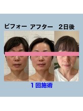 サロンドミジュ(Salon de 美jyu)/小顔・骨格矯正　50代