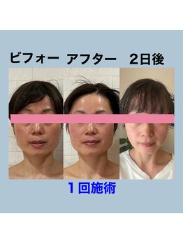 サロンドミジュ(Salon de 美jyu)/小顔・骨格矯正　50代