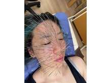 葵の葉鍼灸院