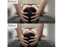 ブレスト サロン 奈良店(Bryst Salon)/小顔症例