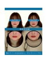 ハリラボ 仙台上杉店(hari Lab.)/【お客様の声】