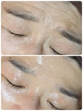 ウララ(ulala)/セルマンビフォアフ