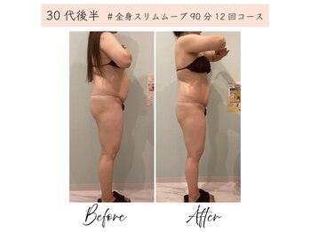 メルローズ 自由が丘店(Melrose)/【お客様の効果写真】