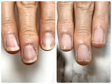 スターネイル(Starnail)/美爪育成ネイルケア