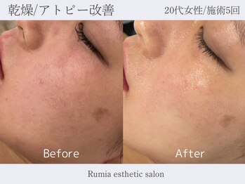 ルミア 目白 池袋(Rumia)