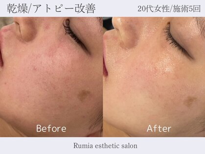 ルミア 目白 池袋(Rumia)の写真