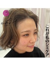 フー(Who?)/これが私のシミケア