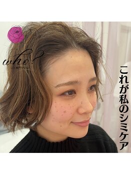 フー(Who?)/これが私のシミケア