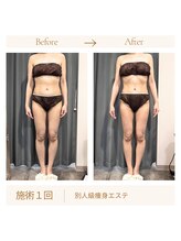 リスキン(Re:Skin)/