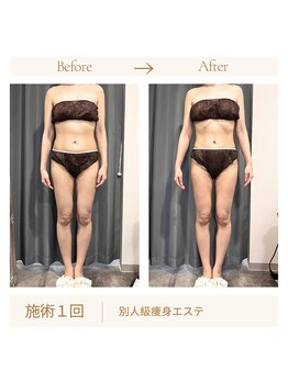 リスキン(Re:Skin)/