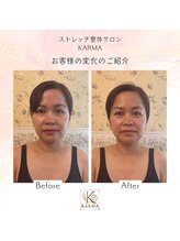 カルマ(KARMA)/MENU【小顔ストレッチ】