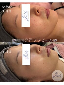 ユフラ(Juhla)/ララピール