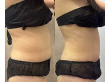 たかやなぎ整体院の雰囲気（ブライダルの方必見！背中、お腹、二の腕の上半身徹底メニュー！）