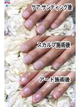 リリーヘブン(LILY HEAVEN)/スカルプの施術工程