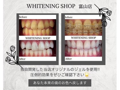 ホワイトニングショップ 富山店の写真