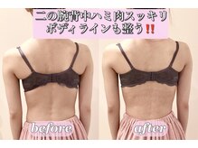 アルビアの雰囲気（ブライダルも大人気★バストだけでなく、二の腕背中引き締め♪）