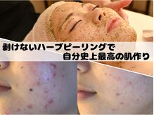 リノリノ(LinoLino)の雰囲気（福島市では希少！剥けないハーブピーリングあり♪）