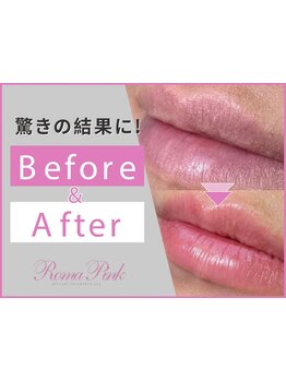 お肌をきれいにしたい