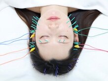 ライフサロン 天神(Life Salon)の雰囲気（小顔・フェイスライン・ほうれい線改善【美容鍼】）