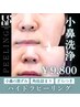 【定期メンテナンス】気になる小鼻の定期メンテナンス(小鼻洗浄)