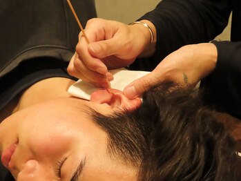 ソウ(SOU)/イヤーリフレ