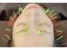 人気No.3 【たるみケア・小顔効果！】 美顔鍼　 70分￥12000→￥10000