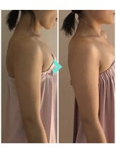 ミルキー(Milky)/お首が前に出ると辛くなる