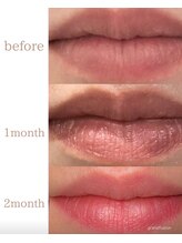 ロゼブランシュ(Rose Blanche)/【ローマピンク】本来のピンクに