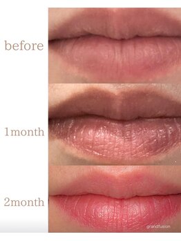 ロゼブランシュ(Rose Blanche)/【ローマピンク】本来のピンクに