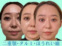 ナチュラルビューティーフェイス 横浜(NBF)