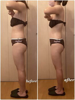 アンフィニ(infini)/全身短期集中コース8回(3ヶ月)