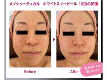 オレンジバナナ 長岡アクロスプラザ店/【ホワイトスノーピール】