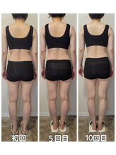 イストアールエム(HISTOIRE.M)/筋膜リリースダイエットコース