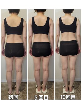 イストアールエム(HISTOIRE.M)/筋膜リリースダイエットコース