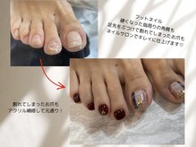 フェリーチェ 中目黒店(felice)/自爪の亀裂補強/フローター