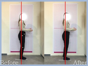 トロ整骨院(toro整骨院)/骨格矯正★1回の効果★20代女性