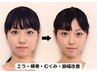 【小顔矯正~極~ リピート専用】小顔矯正＆ヘッドスパ＆首肩凝り対策が可能