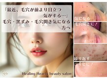 ヒーリングハーツ(Healing Hearts)