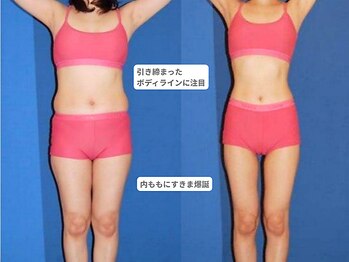 アンシャンテ 芦屋店/医師監修痩身