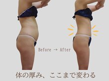 プレリー 自由が丘店/ラジオ派/筋膜リリース