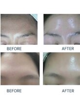 ラウレア(Laule'A)/韓国ムルトクス水光ピーリング